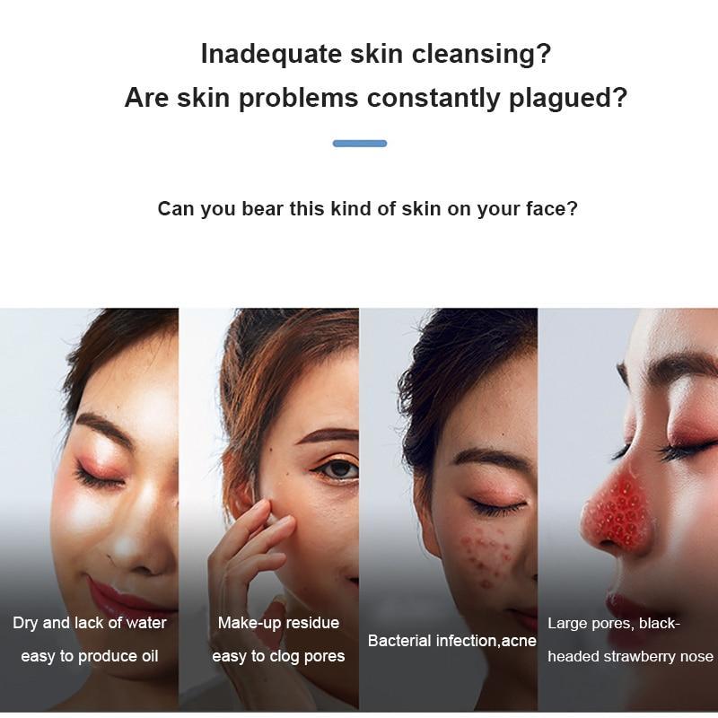 Skincare ad showing electric blackhead vacuum remover treating dryness, clogged pores, acne, large pores, and blackheads
