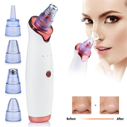 White and rose gold electric blackhead remover vacuum with interchangeable blue plastic nose pore cleaning tips
